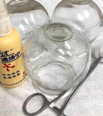 Cupping therapy session