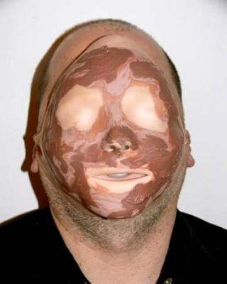 Anonyme