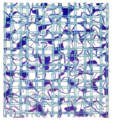 Blue Neuron Cage Blue Neuron Cage