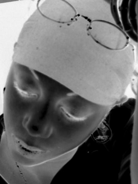 MIGRAINE 